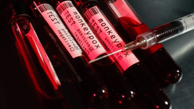 Varíola dos macacos: governo federal determina nível máximo de alerta
