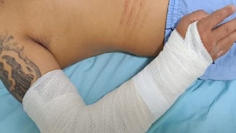 Árbitro é agredido e tem braço quebrado durante jogo no Piauí