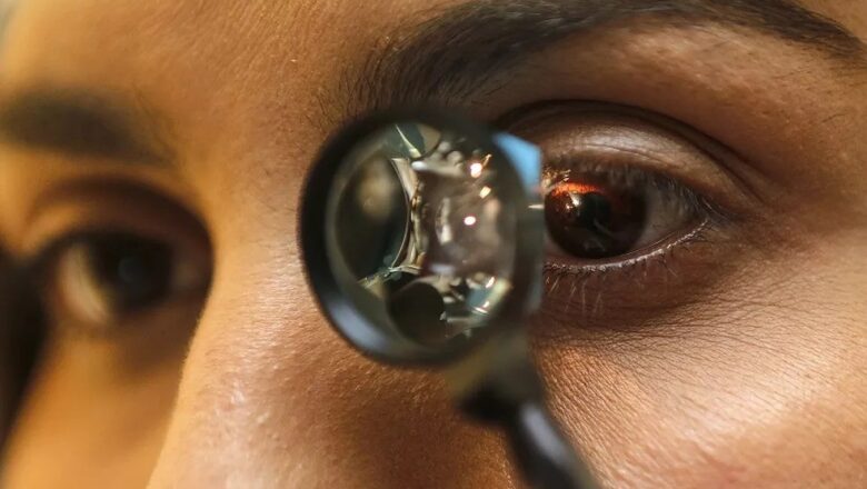 Mutirão de Catarata: Sesapi inicia triagem em municípios da região norte do estado