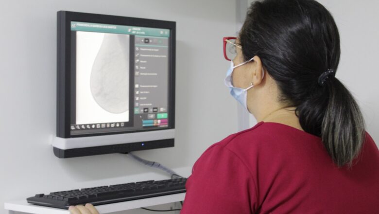 Outubro Rosa: Piauí já realizou mais de 57 mil mamografias em 2025