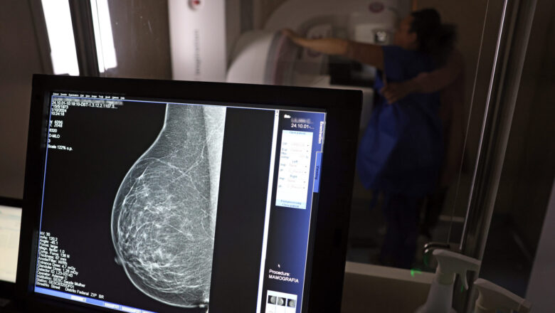 Outubro Rosa: Iaspi libera coparticipação da mamografia durante todo este mês