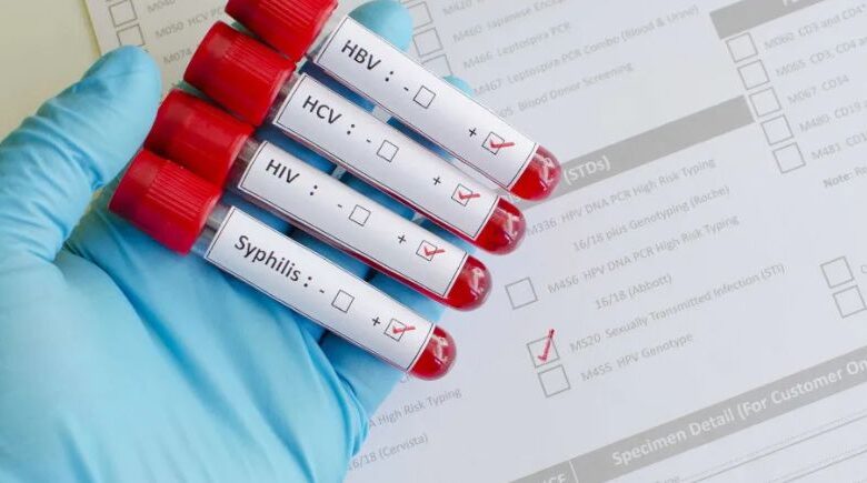 OMS alerta para aumento de números de casos de gonorreia resistentes a antibióticos