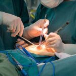 Câncer de pênis causou 2.949 amputações do órgão nos últimos 5 anos