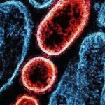 Nipah no Carnaval? Entenda se há risco para o Brasil e quais os sintomas da doença