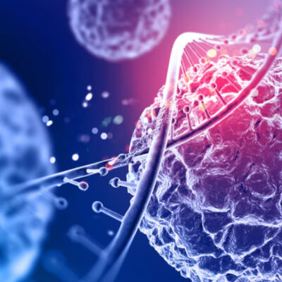 Cientistas descobrem molécula que ‘mata de fome’ células cancerígenas