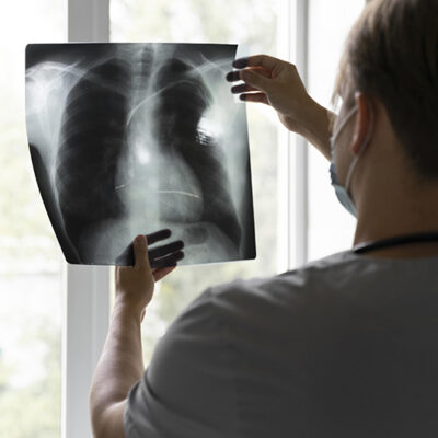 Infecção pulmonar: 10 sintomas que podem indicar a doença