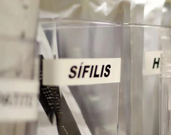 SUS passa a adotar antibiótico para prevenir sífilis e clamídia