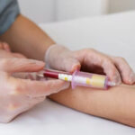 SUS passa a oferecer teste rápido para dengue e amplia diagnóstico precoce