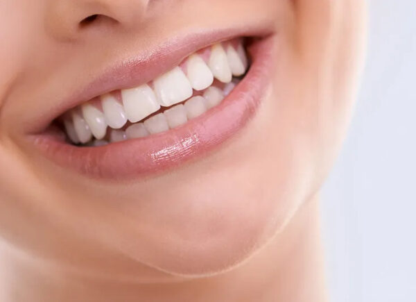 Descubra 4 alimentos que ajudam a deixar os dentes mais brancos de forma natural