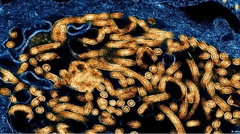 Centro de Controle e Prevenção de Doenças da África confirma 395 casos de ebola e 106 mortes