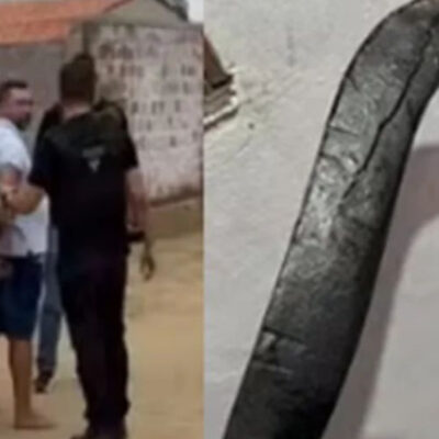 Jovem que teve mãos decepadas por ex com foice passa por reimplante de membro