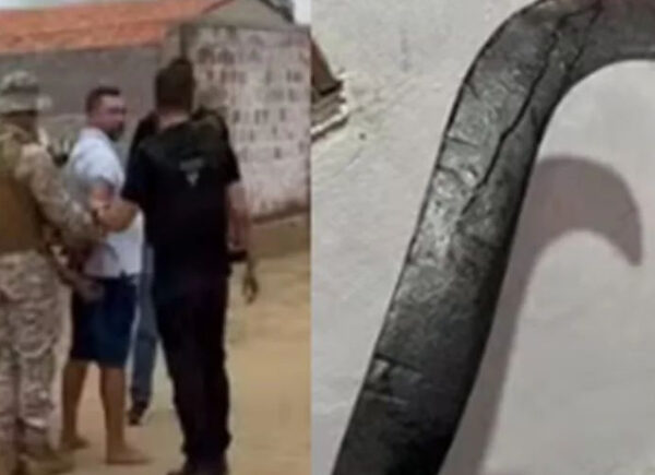Jovem que teve mãos decepadas por ex com foice passa por reimplante de membro