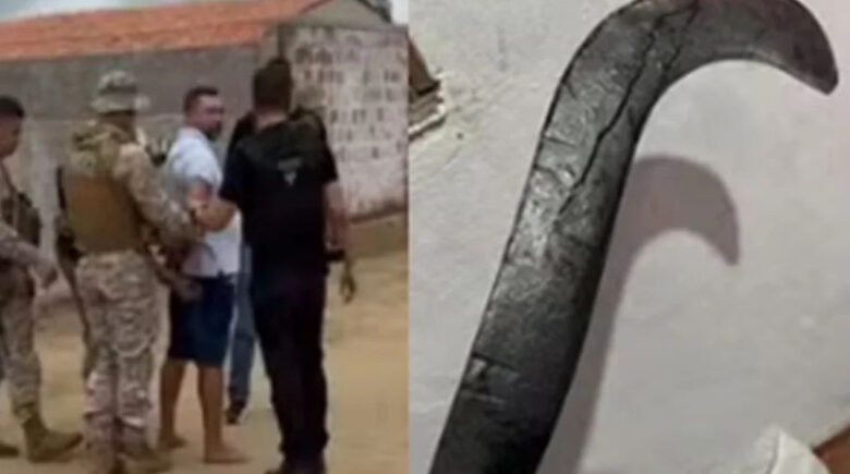 Jovem que teve mãos decepadas por ex com foice passa por reimplante de membro