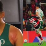 “É papo de MMA”: Palmeiras exibe marcas em Murilo após falta de Carrascal