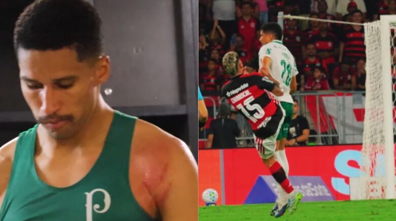 “É papo de MMA”: Palmeiras exibe marcas em Murilo após falta de Carrascal