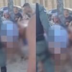 Jovem é mordida por tubarão em praia, no Recife; segundo caso em dois dias