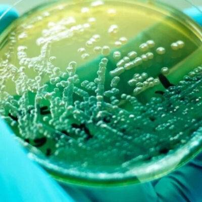 Pseudomonas aeruginosa: sintomas, transmissão e tratamento (é grave?)