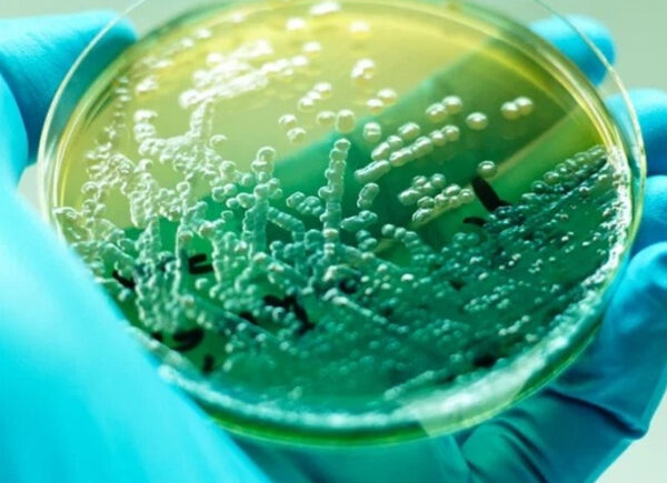 Pseudomonas aeruginosa: sintomas, transmissão e tratamento (é grave?)