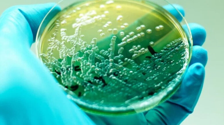 Pseudomonas aeruginosa: sintomas, transmissão e tratamento (é grave?)