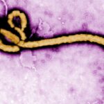São Paulo descarta segundo caso suspeito de Ebola