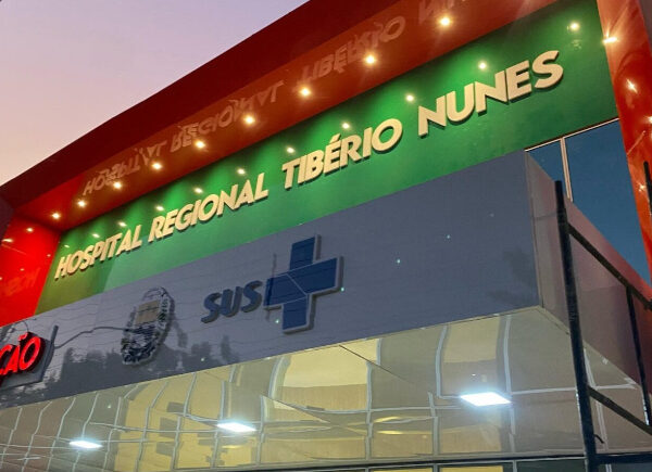 Hospital Regional de Floriano recebe equipamento que permitirá exames e procedimentos de hemodinâmica