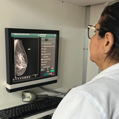Prevenção do câncer de mama: veja como fazer mamografia gratuita pelo SUS no PI