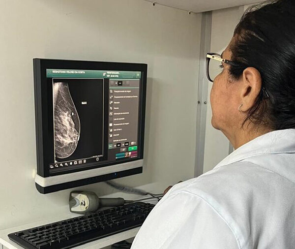 Prevenção do câncer de mama: veja como fazer mamografia gratuita pelo SUS no PI